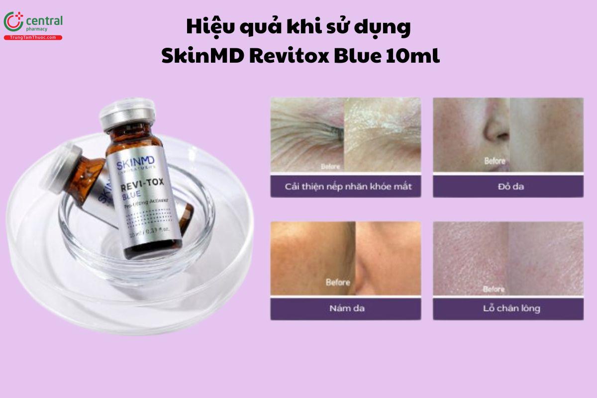 Hiệu quả sử dụng SkinMD Revi-tox Blue 10ml