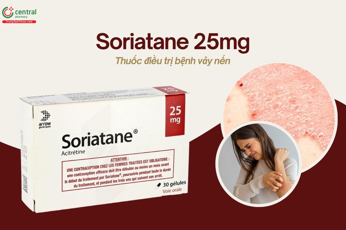 Thuốc Soriatane 25mg điều trị bệnh vảy nến (Hộp 3 vỉ x 10 viên)