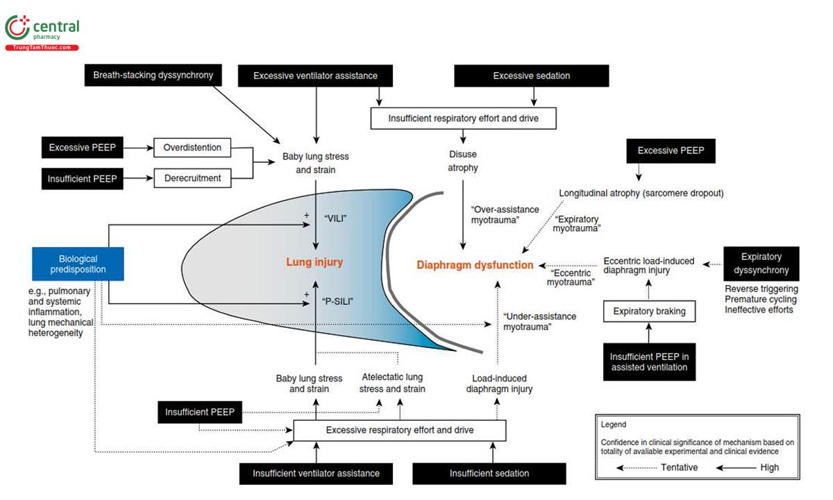 Hình 1. Cơ chế tổn thương phổi và cơ hoành khi thở máy. Cài đặt máy thở và thuốc an thần gây ra những tác động phức tạp và tương tác lên cơ chế tổn thương phổi và cơ hoành. Giảm áp lực do máy thở tạo ra có thể không bảo vệ được phổi do nỗ lực hô hấp tăng lên khi trung khu điều hòa hô hấp còn nguyên vẹn. Việc ức chế trung khu hô hấp để bảo vệ phổi bằng cách tăng cường an thần có thể dẫn đến teo cơ hoành khi không sử dụng. Ngược lại, duy trì điều hòa hô hấp để tránh teo cơ hoành có thể dẫn đến tổn thương phổi do bệnh nhân tự gây ra và tổn thương cơ hoành do tải trọng nếu nỗ lực hô hấp quá mức. Do đó, có thể cần phải cân bằng cẩn thận giữa thông khí quá mức và không đủ và an thần để bảo vệ đồng thời cả phổi và cơ hoành. Tương tự, áp lực dương cuối thì thở ra (PEEP) có thể gây ra những tác động phức tạp và cạnh tranh lên cơ chế chấn thương và tất cả những tác động này có thể cần được xem xét khi cài đặt PEEP ở từng bệnh nhân. Nguy cơ tổn thương phổi và cơ hoành có thể “phụ thuộc vào liều lượng”—nguy cơ tổn thương phụ thuộc vào mức độ stress và strain ở phổi trẻ cũng như mức độ nỗ lực hô hấp được tạo ra trong quá trình hỗ trợ hô hấp và không đồng bộ. P-SILI = tổn thương phổi do bệnh nhân tự gây ra; VILI = tổn thương phổi do máy thở.
