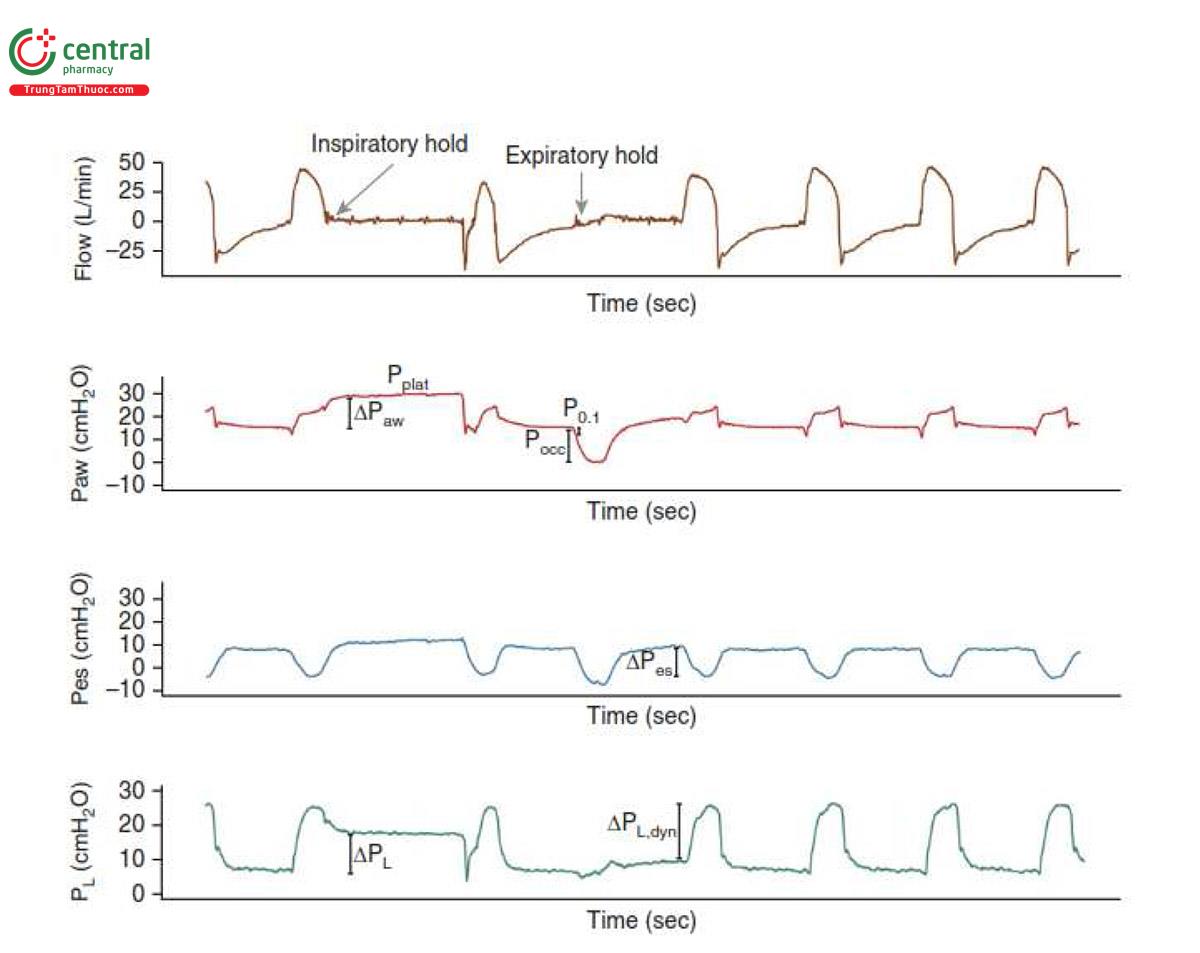 Hình 2. Các chiến lược theo dõi thông khí bảo vệ phổi và cơ hoành. Những biểu đồ dạng sóng này minh họa tiện ích của việc theo dõi bán xâm lấn bằng phép đo áp lực thực quản và các chiến lược theo dõi không xâm lấn bằng cách sử dụng các thao tác hô hấp trên máy thở. Sự dao động áp lực thực quản (Ps) (∆Pes) phản ánh nỗ lực hô hấp của bệnh nhân. Sự dao động áp lực xuyên phổi (PL) (∆PL,dyn; sự chênh lệch giữa áp lực đường thở [Paw] và Pes) trực tiếp đánh giá stress động của phổi. Áp lực đẩy đường thở động (∆Paw) và áp lực đẩy xuyên phổi (∆PL) có thể được định lượng ngay cả khi bệnh nhân thực hiện nỗ lực hô hấp tự phát bằng cách áp dụng biện pháp tắc cuối thì hít vào để đo áp lực cao nguyên (Pplat). Pplat có thể cao hơn Paw đỉnh khi bệnh nhân thực hiện các nỗ lực hô hấp tự phát (như hình) vì phổi được bơm căng lên nhờ nỗ lực của cơ hô hấp cũng như áp lực dương từ máy thở. Có thể sử dụng dao động Paw trong Pocc để dự đoán cả ∆PL,dyn và nỗ lực hô hấp (53). Áp lực tắc đường thở (P0,1) có thể được sử dụng để phát hiện trung khu điều hòa hô hấp không đủ hoặc quá mức. Pocc = áp lực tắc thở ra.