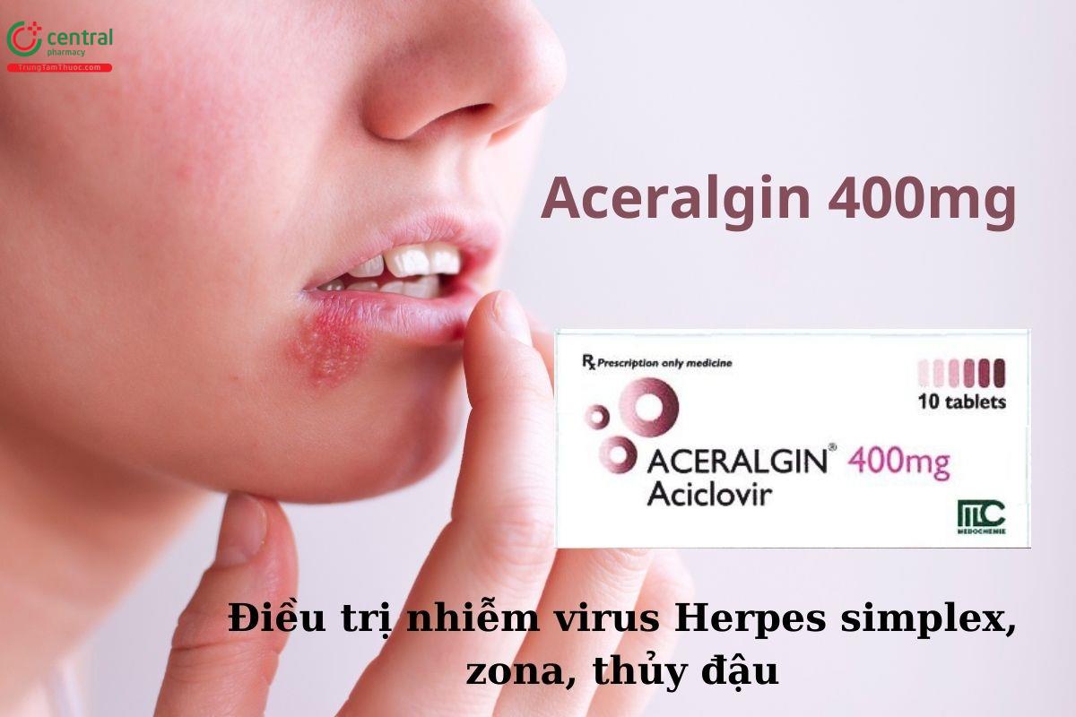 Thuốc Aceralgin 400mg