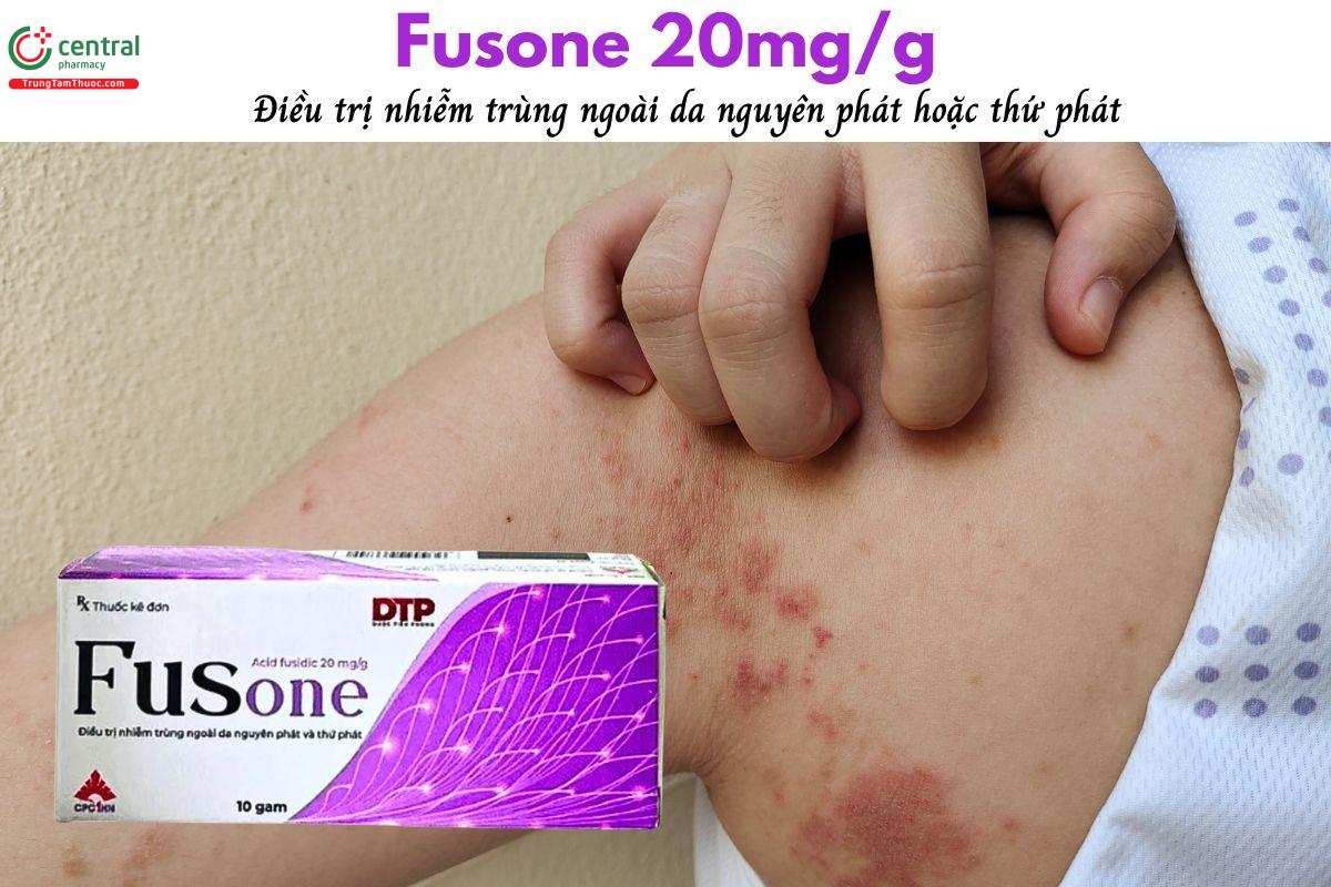 Thuốc Fusone 20mg/g điều trị nhiễm trùng ngoài da nguyên phát, thứ phát