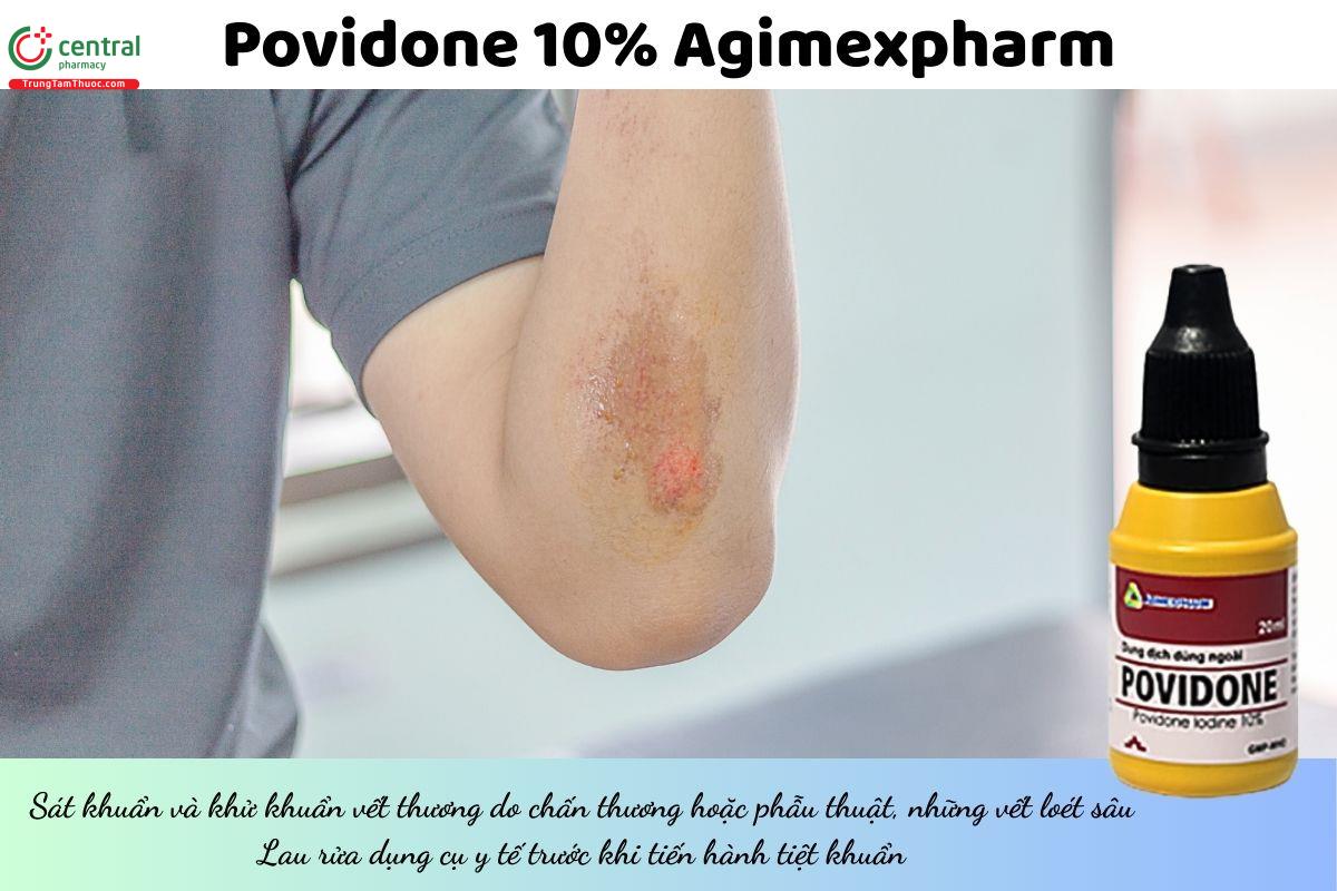 Thuốc Povidone 10% Agimexpharm giúp sát khuẩn các vết thương do chấn thương hoặc phẫu thuật, những vết loét sâu, lau rửa dụng cụ y tế trước khi tiệt khuẩn