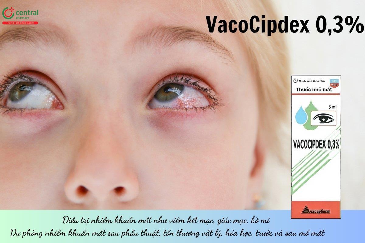 Thuốc VacoCipdex 0,3% chứa Ciprofloxacin điều trị nhiễm khuẩn mắt như viêm kết mạc, giác mạc, bờ mi và dự phòng nhiễm khuẩn sau phẫu thuật hoặc tổn thương mắt