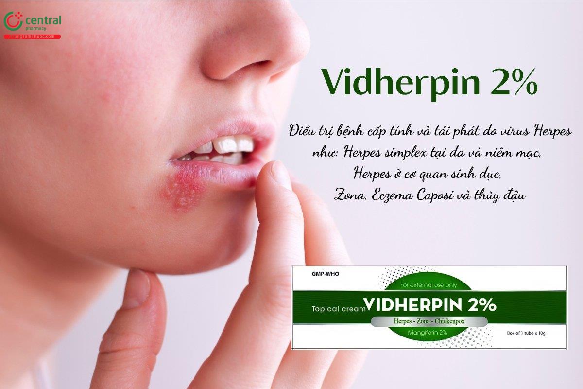 Thuốc Vidherpin 2% chứa Mangiferin điều trị các bệnh do virus Herpes gây ra như Herpes simplex da niêm mạc, Herpes sinh dục, Zona, Eczema Caposi, thủy đậu