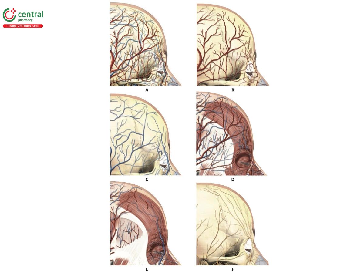 Hình 8.5 Hình nghiêng bên phải của trán. A. Phân bố mạch máu và thần kinh tương ứng. B. Phân bố động mạch. C. Phân bố tĩnh mạch. D. Phân bố động mạch và tĩnh mạch trên cơ trán và cơ vòng mắt (OM). E. Minh họa tương tự D sau khi loại bỏ cân thái dương nông và nhánh trán của động mạch thái dương nông (STA). Phân bố động mạch và tĩnh mạch phía trên cân thái dương sâu. F. Phân bố thần kinh.