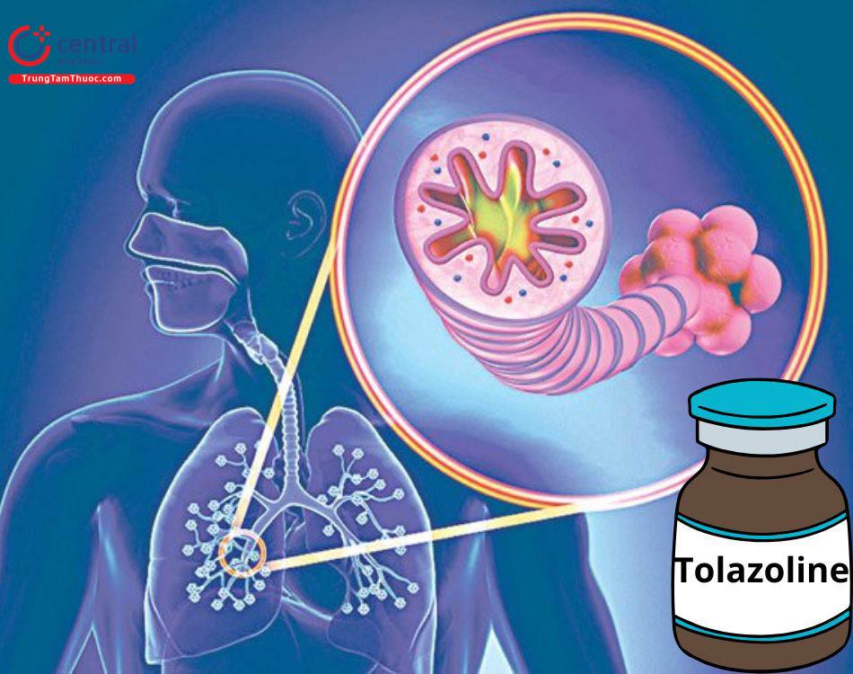 Tolazoline cải thện tăng áp lực động mạch phổi