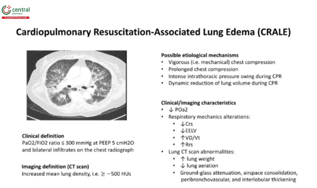 Hình 2. Phù phổi liên quan đến hồi sức tim phổi. Crs, độ giãn nở của hệ hô hấp; EELV, thể tích phổi cuối thì thở ra; HU, đơn vị Hounsfield; PaO2/FiO2, áp lực riêng phần oxy động mạch/nồng độ oxy hít vào; Rrs, sức cản của hệ hô hấp; VD/VT, tỷ lệ khoảng chết.