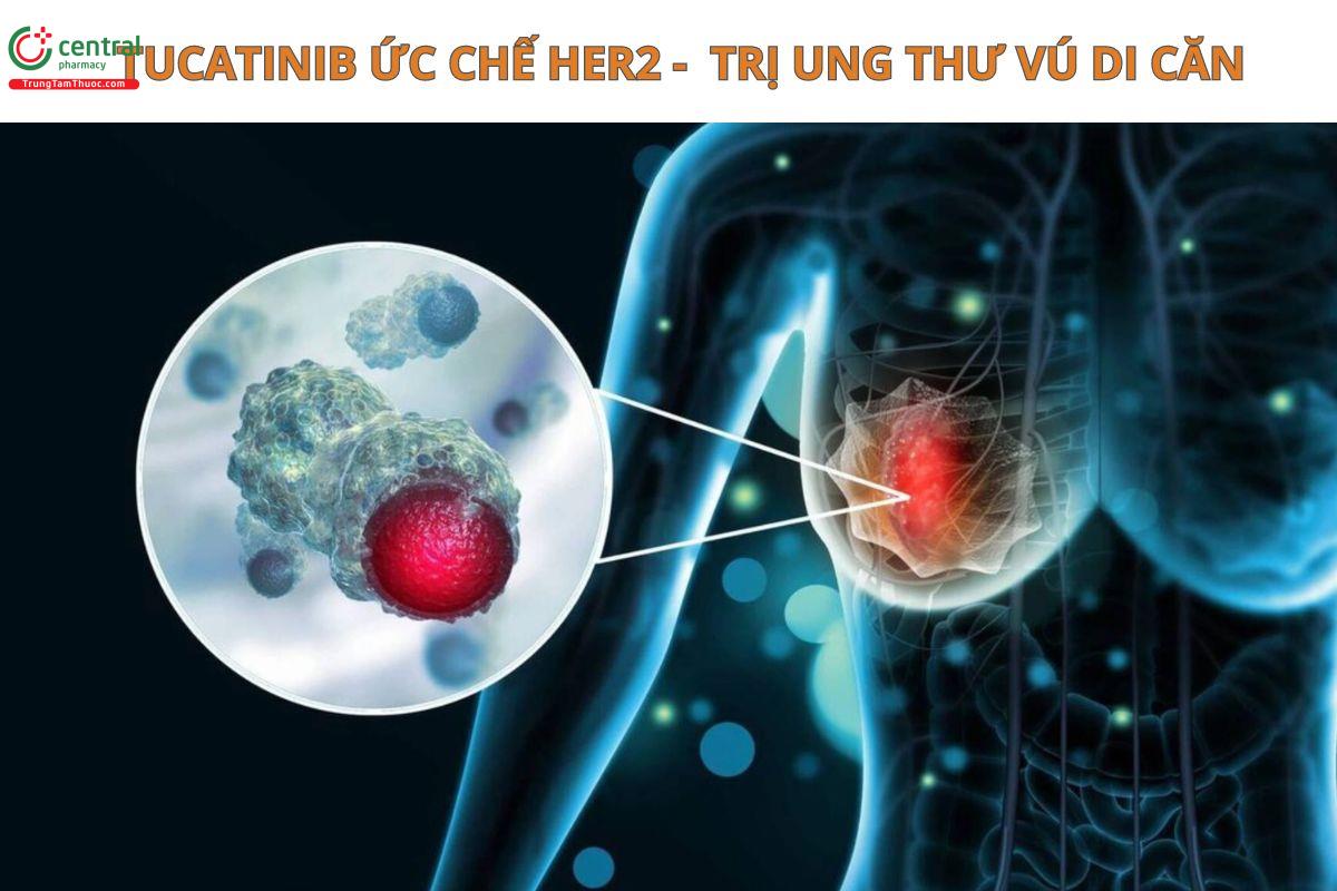 Tucatinib điều trị ung thư vú