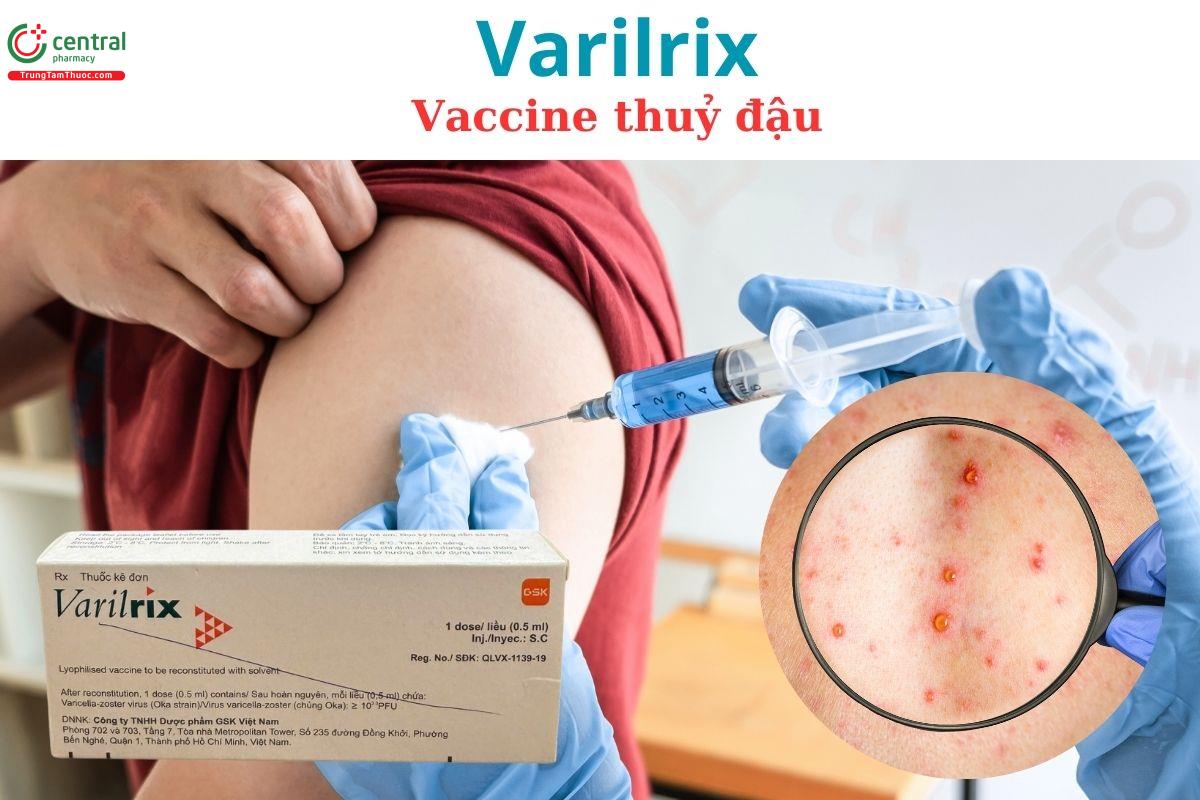 Vaccine thuỷ đậu Varilrix