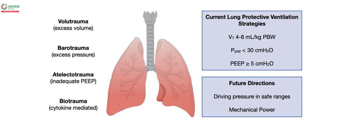 Hình 2. Cơ chế sinh bệnh của VILI và mục tiêu giảm thiểu VILI.