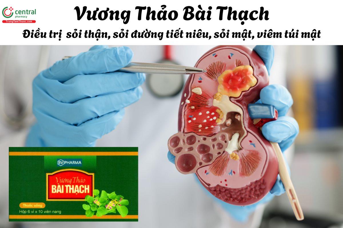 Thuốc Vương Thảo Bài Thạch - Điều trị sỏi thận, sỏi tiết niệu, sỏi túi mật