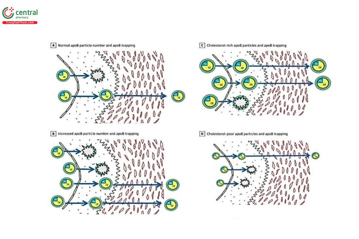 Hình 1. Cách mà các Lipoprotein chứa ApoB bị bẫy vào thành mạch và gây xơ  vữa. A: các hạt Lipoprotein chứa ApoB bị mắc bẫy. B: Số lượng hạt tăng lên thì số  lượng hạt bị mắc bẫy cũng tăng theo. C: Các hạt Lipoprotein giàu Cholesterol thì  lớn hơn và khó mắc bẫy hơn. D: Các hạt Lipoprotein nghèo Cholesterol thì nhỏ  hơn và dễ mắc bẫy hơn.