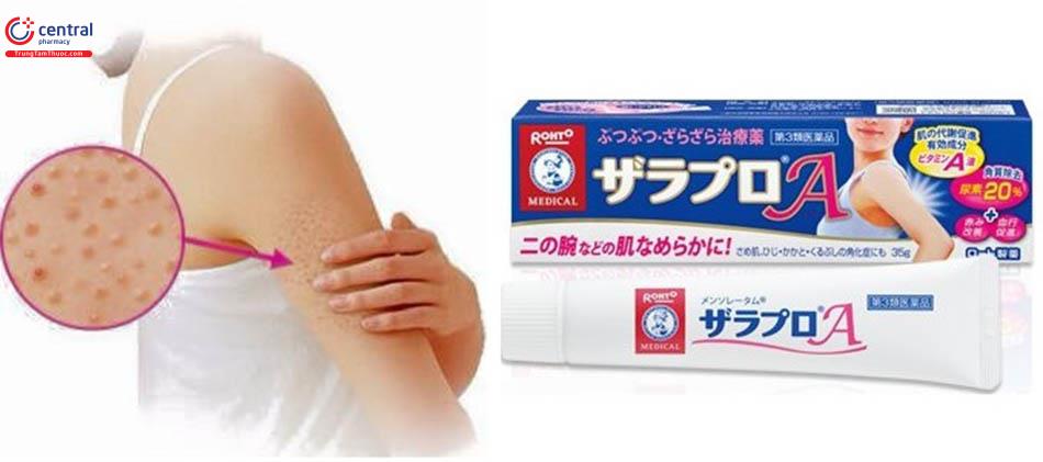 Hình ảnh kem trị viêm nang lông Zaraporo Rohto của Nhật