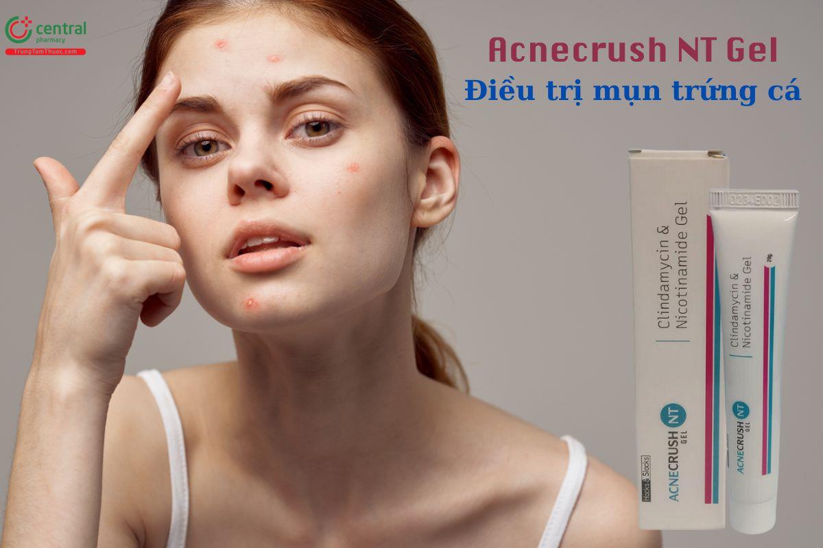 Acnecrush NT Gel - Điều trị mụn trứng cá, mụn viêm, mụn mủ