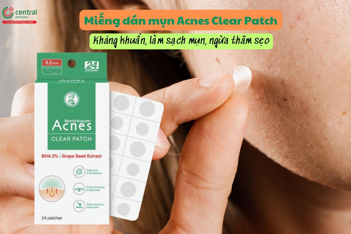 Miếng dán mụn Acnes Clear Patch - Kháng khuẩn, ngừa thâm sẹo