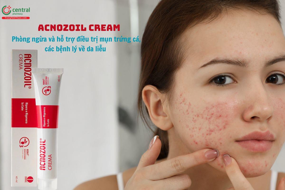 Acnozoil Cream giúp phòng ngừa và điều trị mụn trứng cá, viêm da