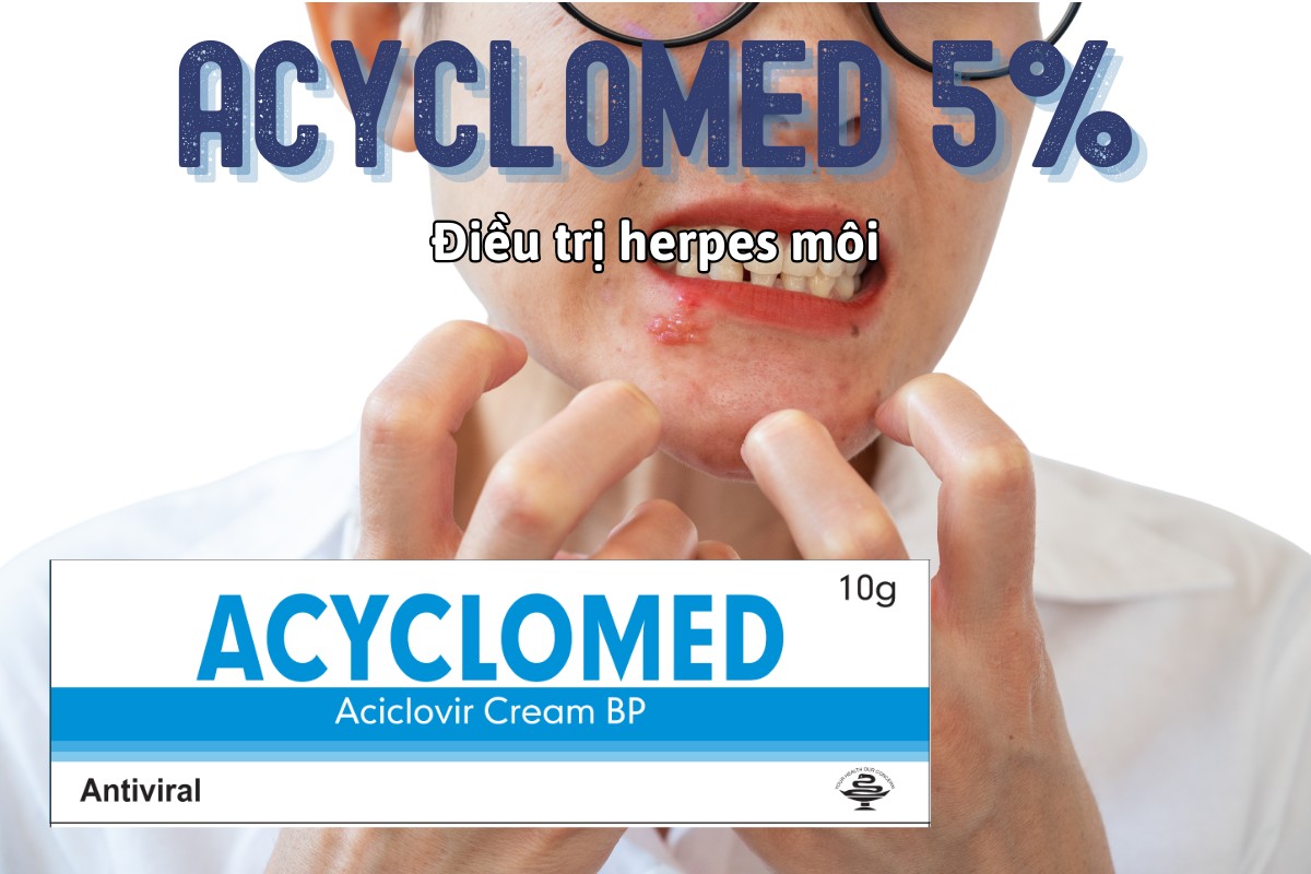 Thuốc Acyclomed 5% điều trị nhiễm Herpes simplex trên da như herpes môi