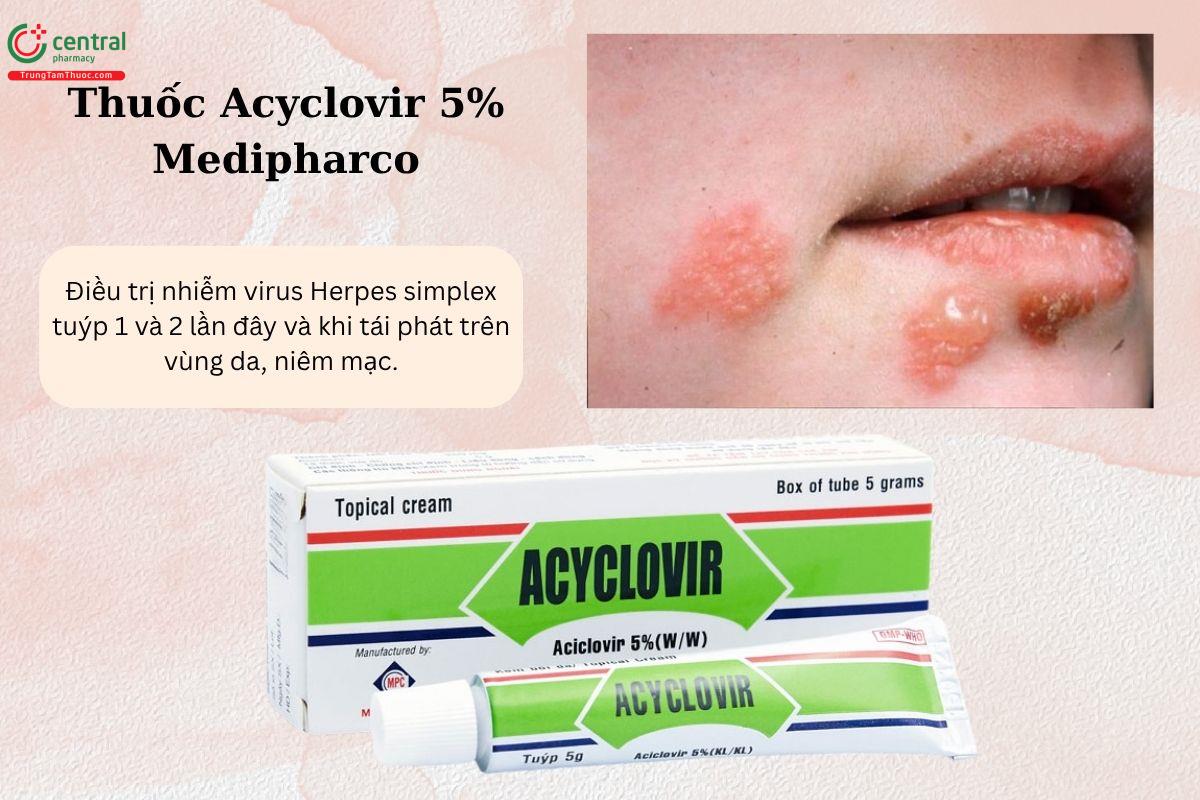 Chỉ định của thuốc Acyclovir 5% Medipharco