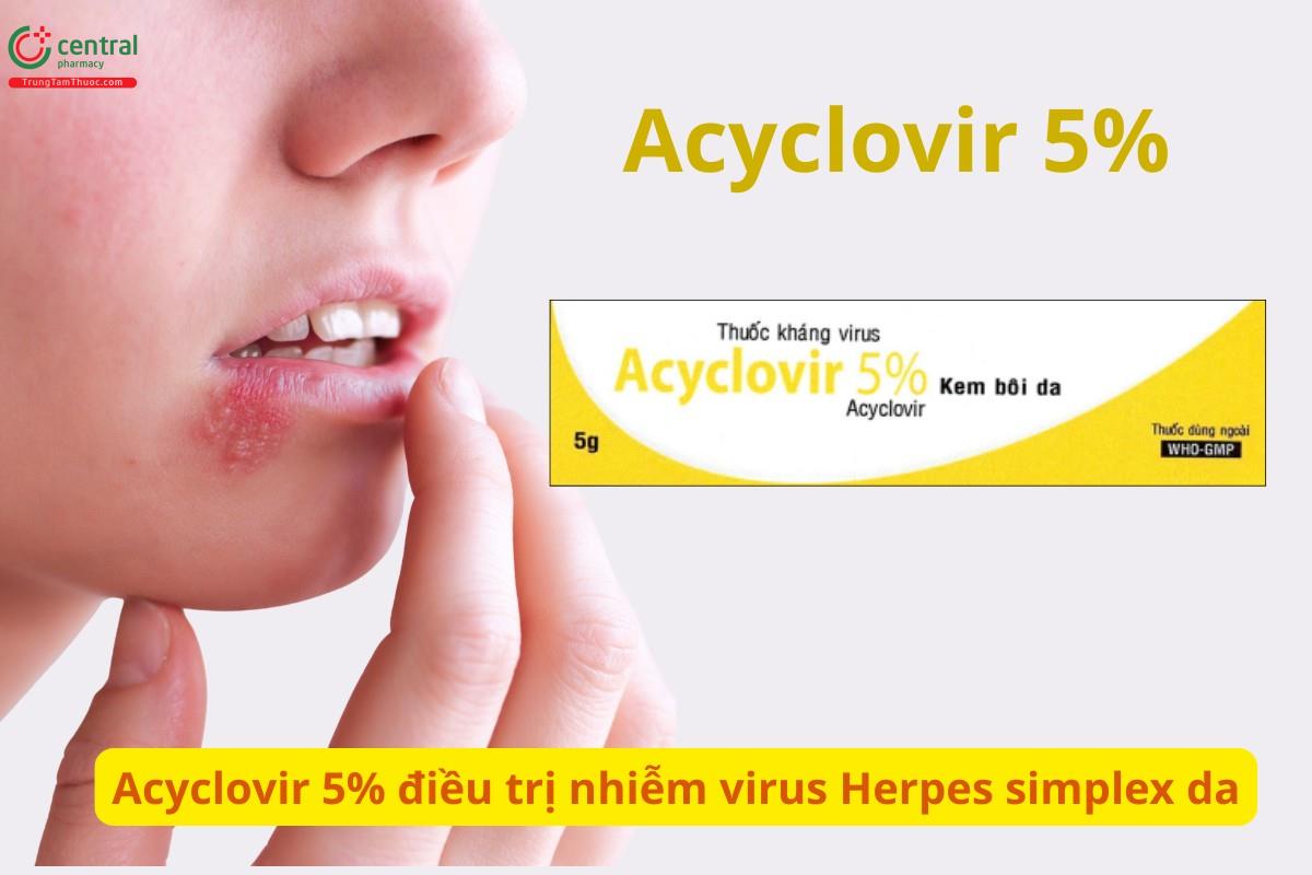 Acyclovir 5% điều trị nhiễm virus Herpes simplex da 