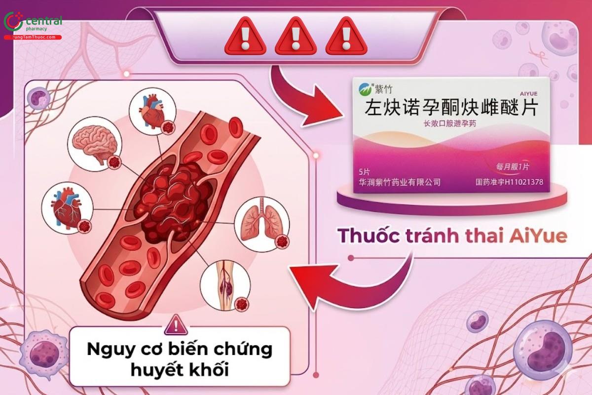 Nguy cơ biến chứng huyết khối khi sử dụng thuốc tránh thai AiYue
