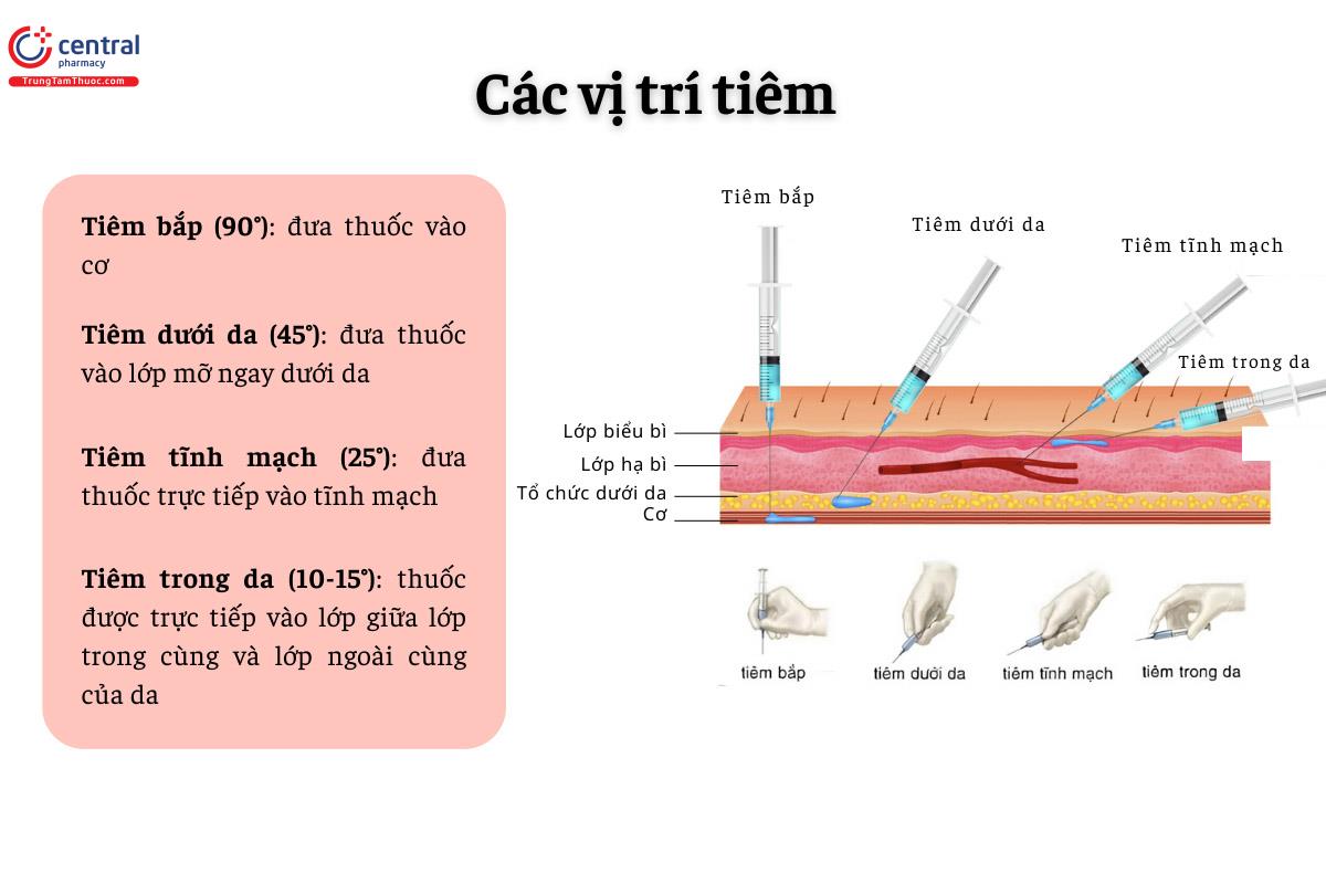 Thuốc tiêm có đa dạng vị trí tiêm