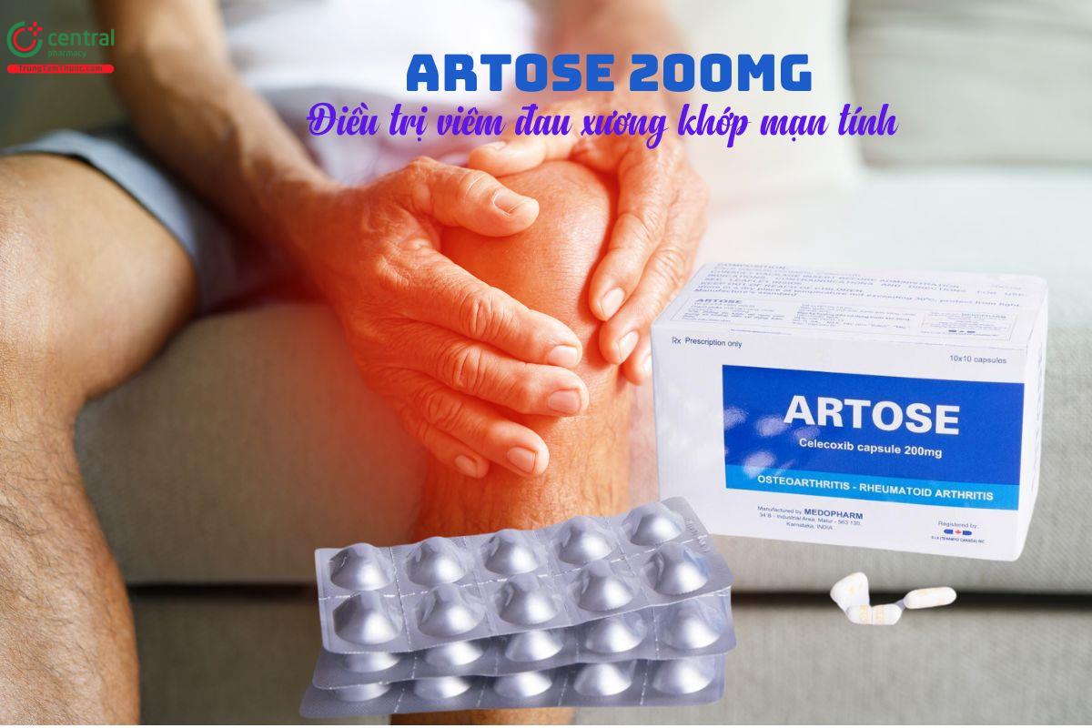 Thuốc Artose 200mg - Điều trị viêm đau xương khớp mạn tính