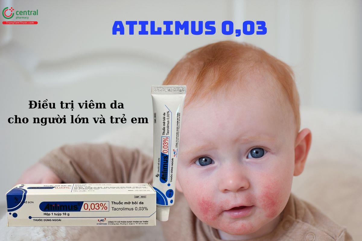 Thuốc Atilimus 0,03% điều trị viêm da cơ địa vừa đến nặng