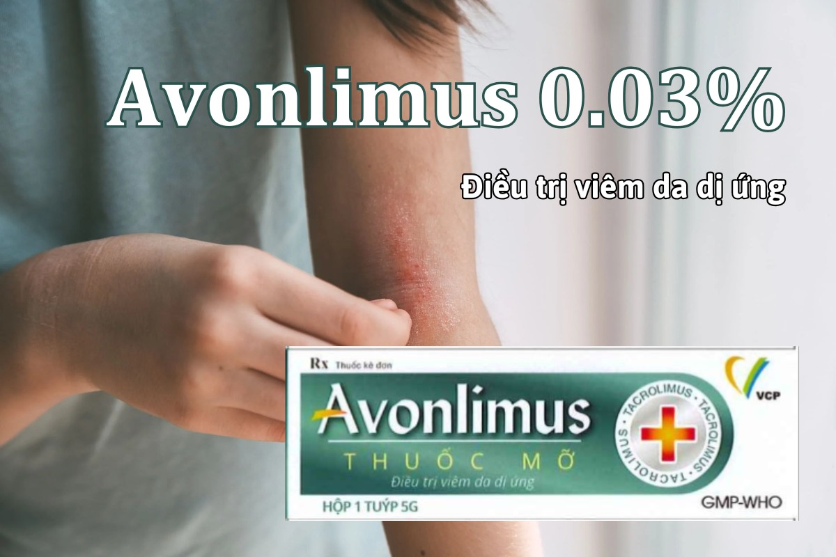 Thuốc Avonlimus 0.03% điều trị viêm da dị ứng