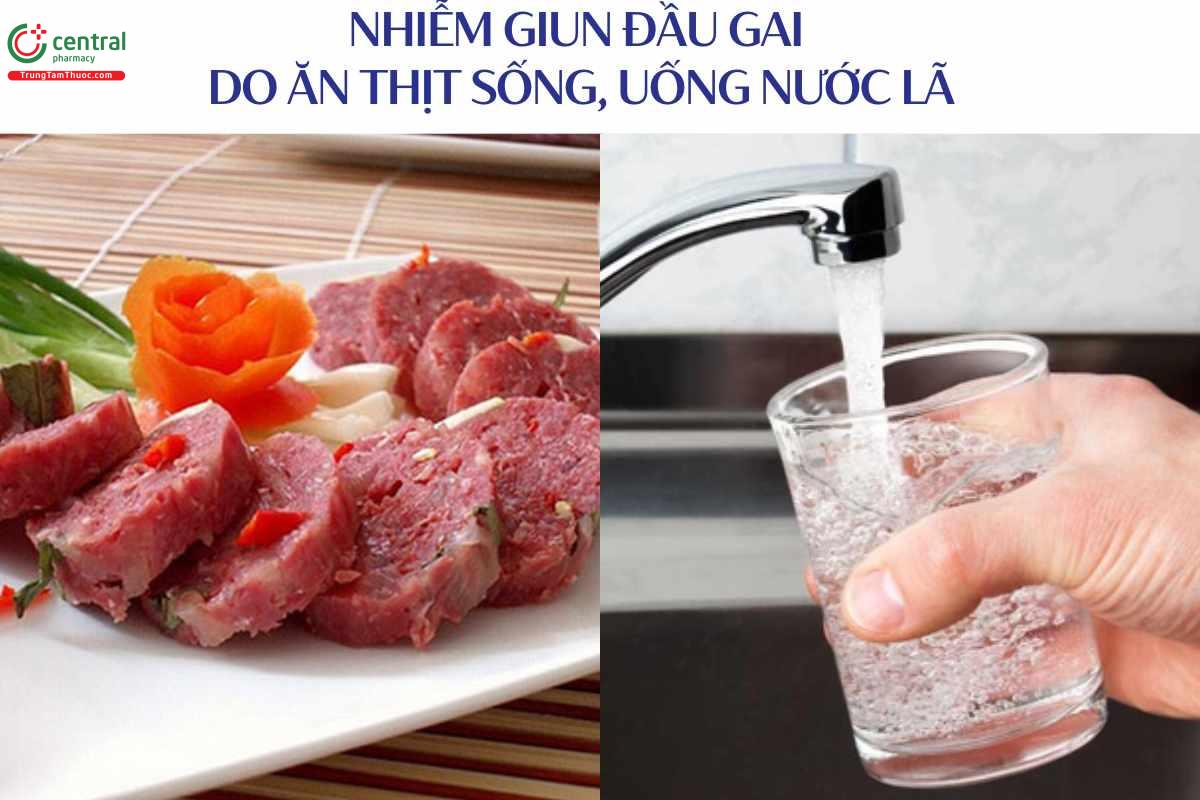 Nguồn lây nhiễm giun đầu gai