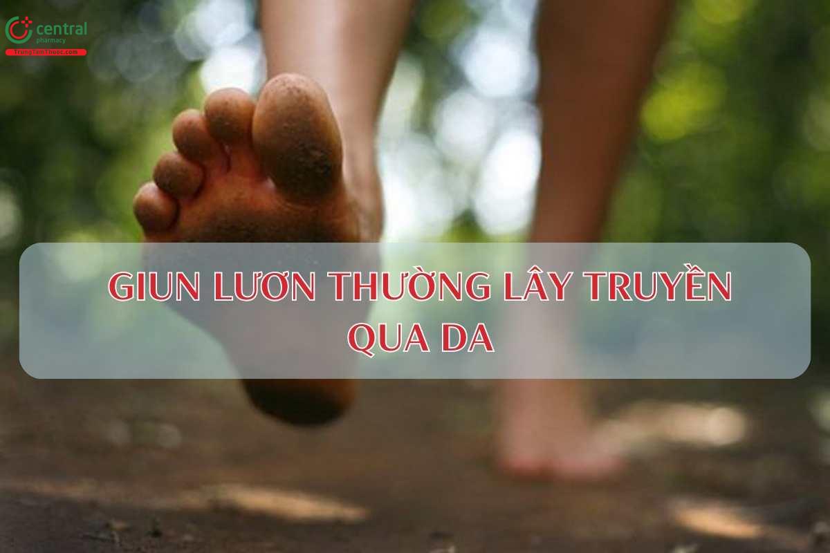 Bệnh giun lươn có thể lây trực tiếp qua da