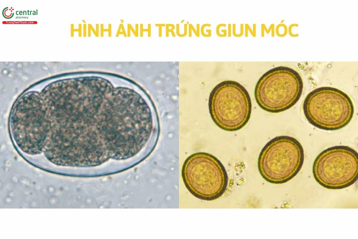 Hình ảnh trứng giun móc