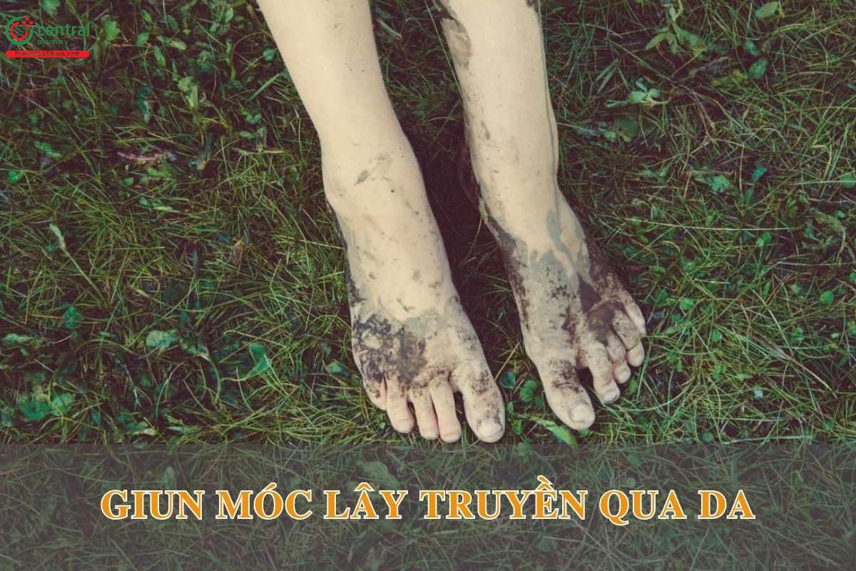Ấu trùng giun móc có thể chui qua da