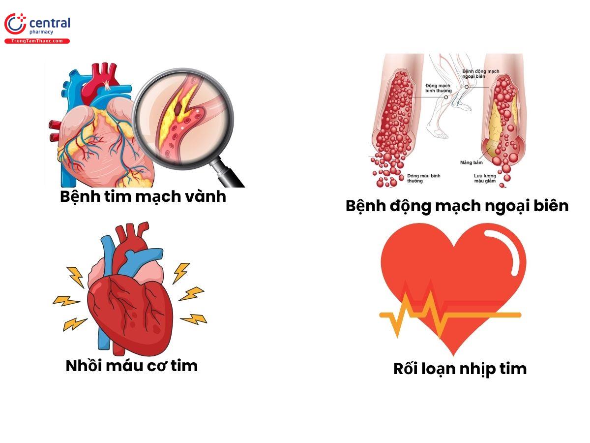 Các bệnh lý tim mạch thường gặp