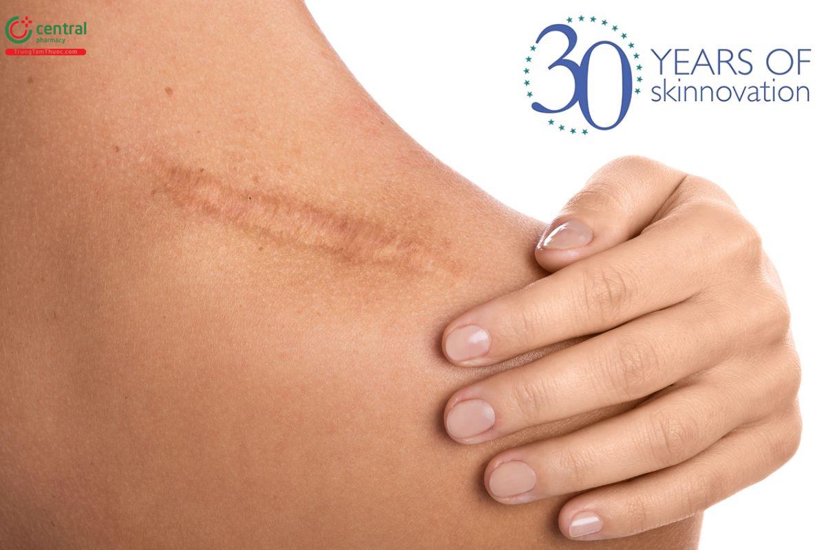 Biodermis - Cung cấp các giải pháp chăm sóc da và điều trị sẹo hàng đầu