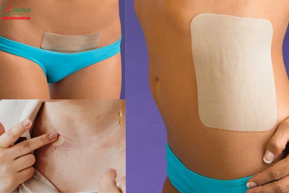 Biodermis - Điều trị sẹo, phục hồi làn da