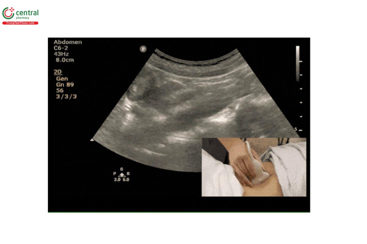 Điều chỉnh đầu dò