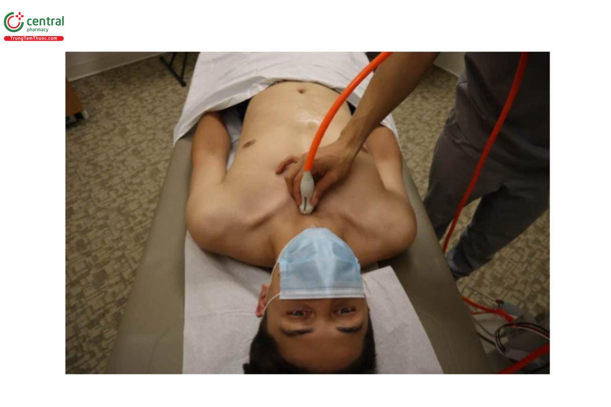 Vị trí đầu dò khi khảo sát động mạch chủ từ hõm trên ức 