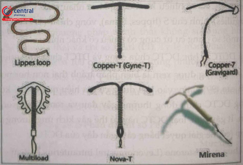 Hình 2. Các loại dụng cụ tử cung 