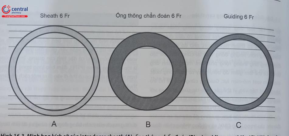 Hình 16.3. Minh họa kích cỡ của introducer sheath (A), ống thông chẩn đoán (B), và guiding can thiệp (C). Với sheath, đường kính được tính là đường kính trong. Với ống thông chẩn đoán hay can thiệp, đường kính được tính là đường kính ngoài. Ống thông can thiệp có thành mỏng hơn, vì thế lòng rộng hơn ống thông chẩn đoán.