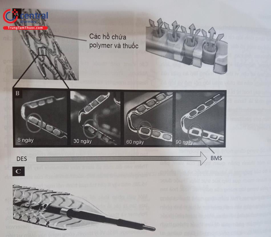 Hình 16.28. Thiết kế các “hồ chứa” polymer trên khung stent.