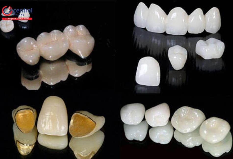 Các loại răng sứ rất đa dạng