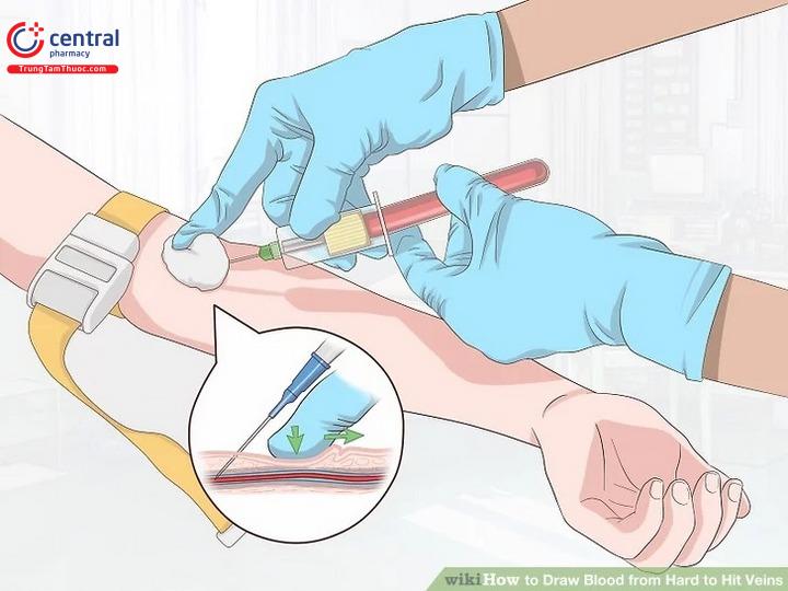 Cách sử dụng bút lấy máu chân không