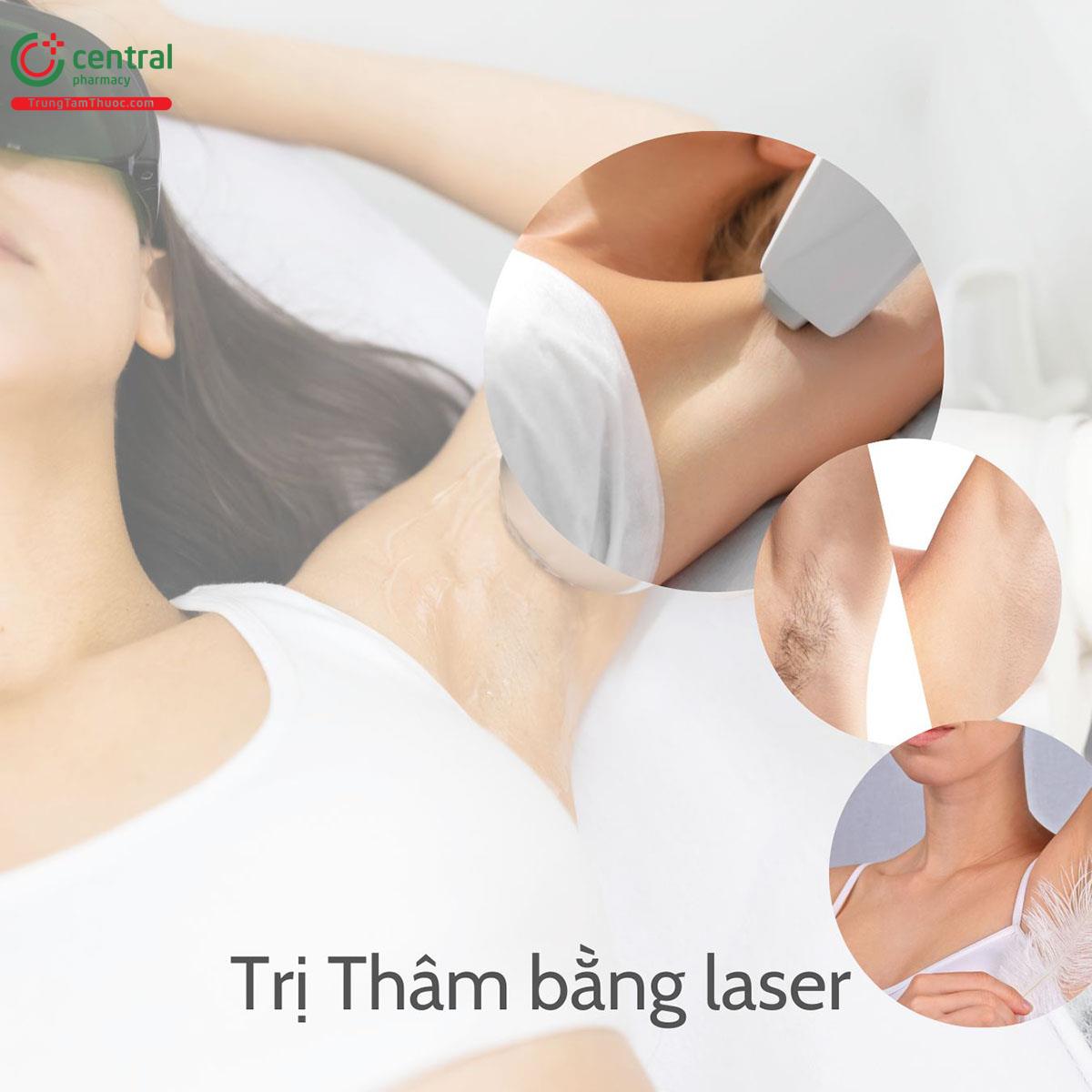 Trị thâm nách bằng Laser