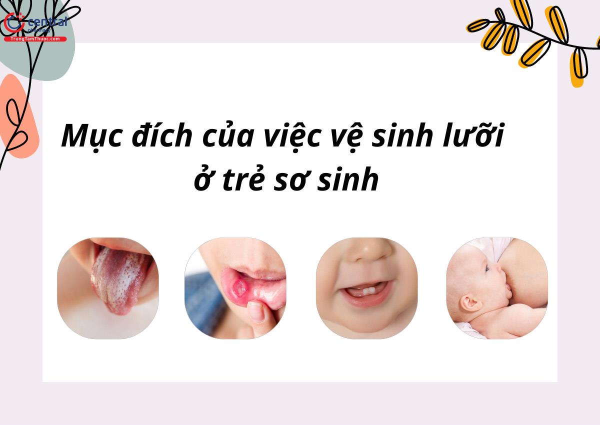 Mục đích rơ lưỡi cho trẻ sơ sinh