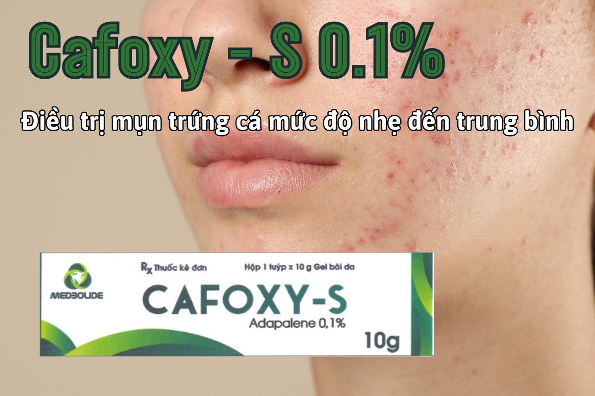 Thuốc Cafoxy - S 0.1% sử dụng trong điều trị mụn trứng cá mức độ nhẹ đến trung bình