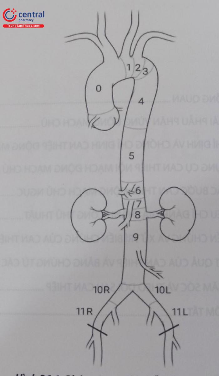 Hình 26.1. Phân vùng giải phẫu động mạch chủ