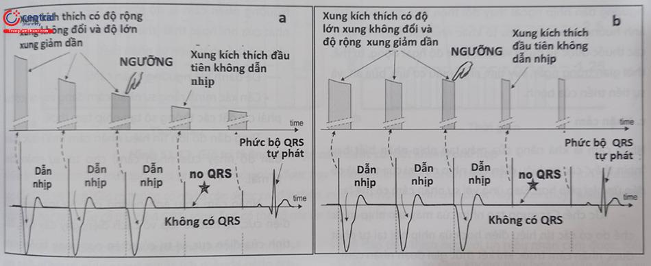 Hình 51.10. Phương pháp xác định ngưỡng dẫn nhịp: a) Giảm dần độ lớn của xung trong khi thời gian của xung kích thích không thay đổi; b) giảm dần thời gian của xung trong khi độ lớn của xung kích thích không thay đổi