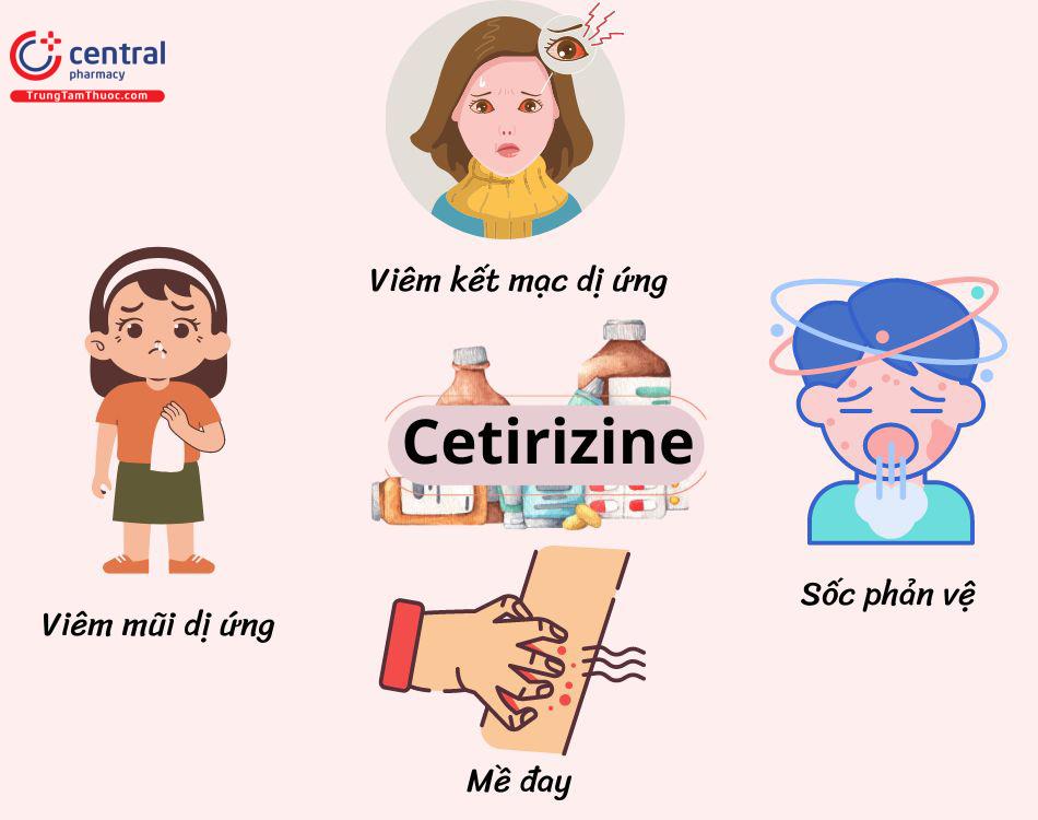 Công dụng của cetirizine
