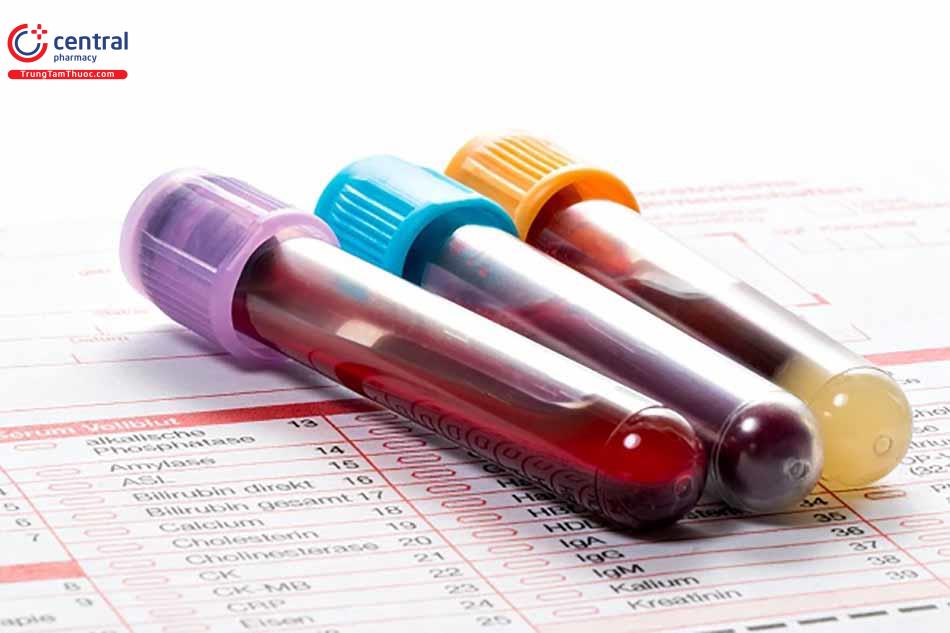 Xét nghiệm máu tìm kháng thể RNP giúp chẩn đoán bệnh mô liên kết hỗn hợp